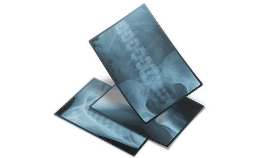 Основные виды рентгенографии