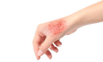 Когда обращаться к инфекционисту