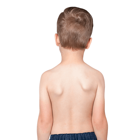 Шрот-терапия